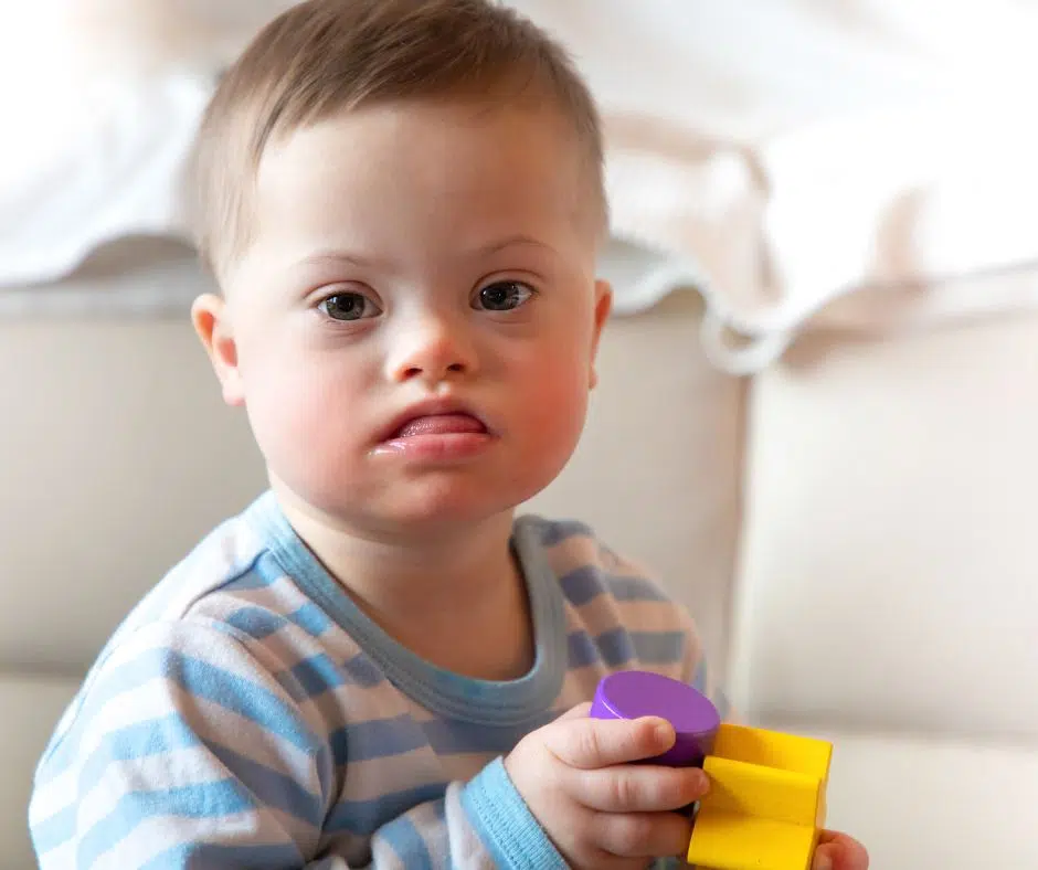 تأهيل أطفال متلازمة داون بالكويت